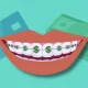 Understanding the Fine Print: Key Terms in Dental Payment Plans