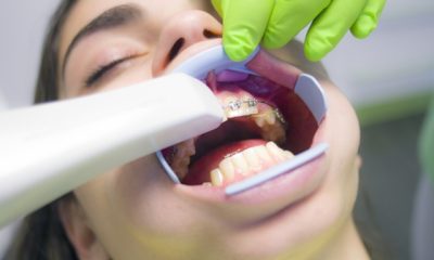 How Good Dental Hygiene Prevents Serious Health Issues