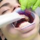 How Good Dental Hygiene Prevents Serious Health Issues