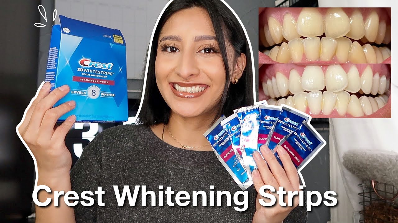 Crest Whitening Strips: A Bright Smile in a Box